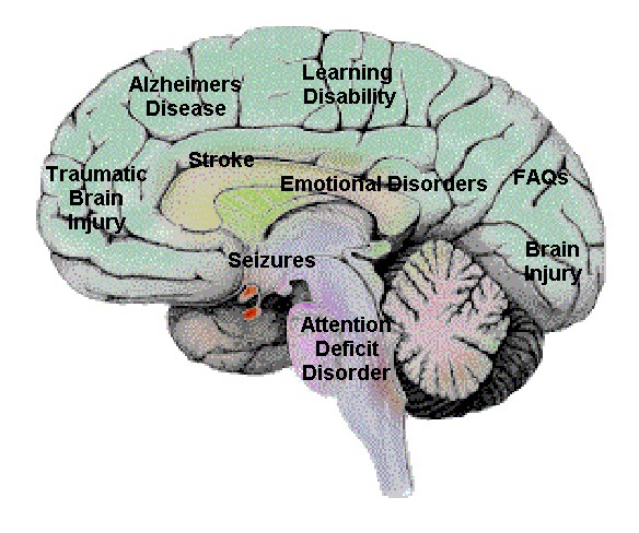 Our beloved brain